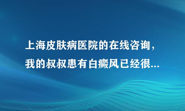 上海皮肤病医院的在线咨询，我的叔叔患有白癜风已经很多年了，颈部都明显增多，有时看了觉得很害怕。