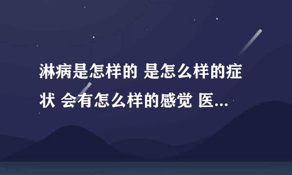 淋病是怎样的 是怎么样的症状 会有怎么样的感觉 医治能好吗