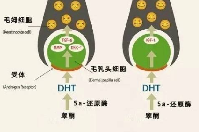 5a还原酶 是什么东西