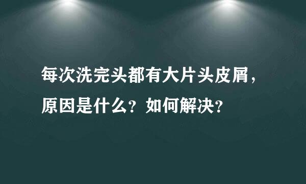 每次洗完头都有大片头皮屑，原因是什么？如何解决？