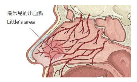 流鼻血怎么快速止血?