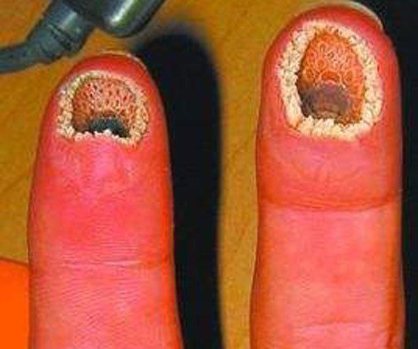 空手指是啥 恶心图片是什么病是真的吗