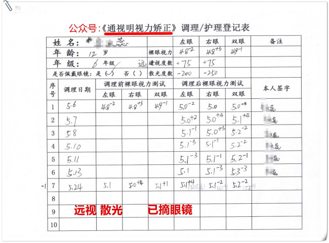 治疗近视眼最好的方法