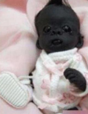 那个一出生就轰动世界，被称为“世界最黑”的婴儿，如今怎样了？