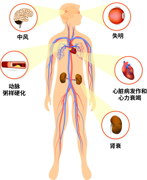 长期吃降压药，就不能长寿吗？