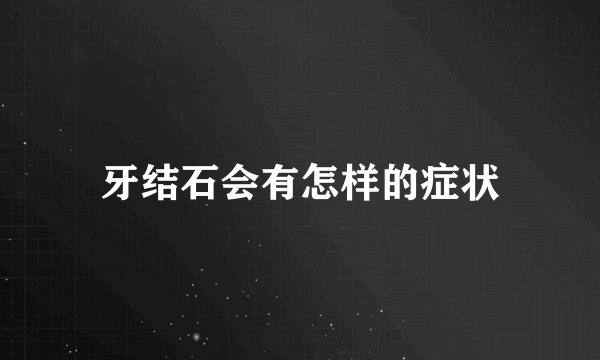 牙结石会有怎样的症状