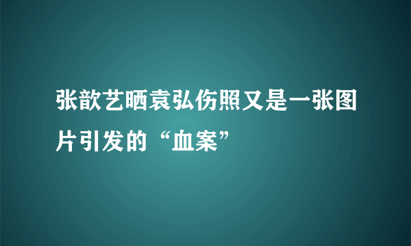 张歆艺晒袁弘伤照又是一张图片引发的“血案”