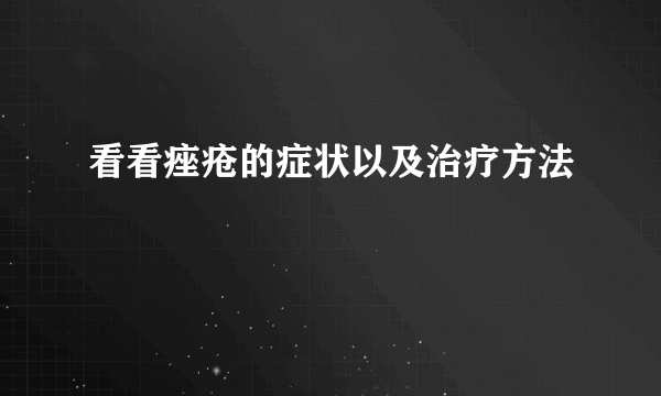 看看痤疮的症状以及治疗方法