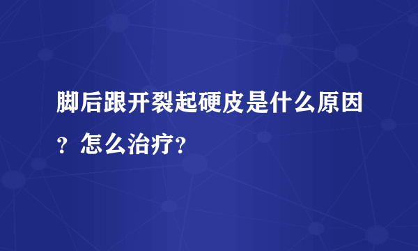 脚后跟开裂起硬皮是什么原因？怎么治疗？