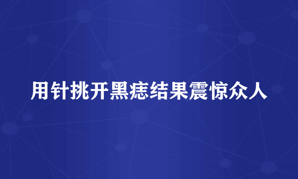 用针挑开黑痣结果震惊众人