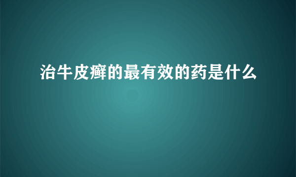 治牛皮癣的最有效的药是什么