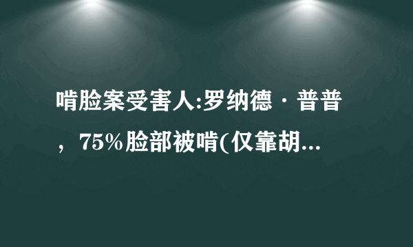 啃脸案受害人:罗纳德·普普，75%脸部被啃(仅靠胡须辨认)