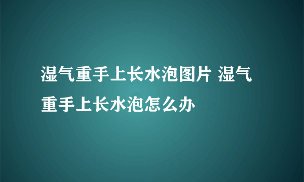 湿气重手上长水泡图片 湿气重手上长水泡怎么办