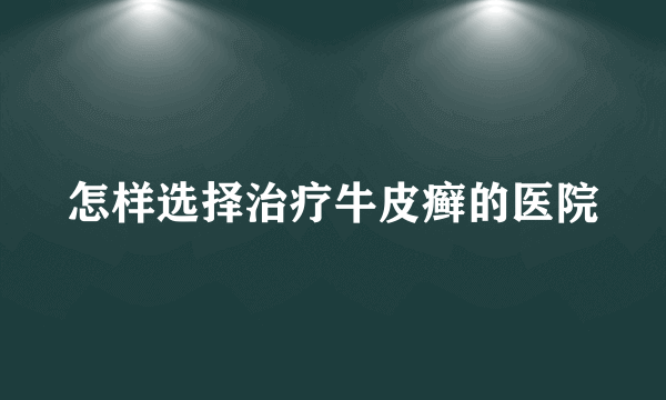 怎样选择治疗牛皮癣的医院