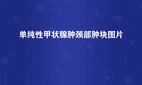 单纯性甲状腺肿颈部肿块图片