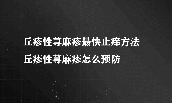 丘疹性荨麻疹最快止痒方法 丘疹性荨麻疹怎么预防