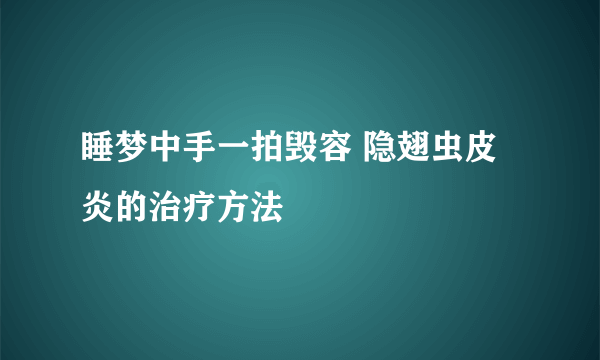 睡梦中手一拍毁容 隐翅虫皮炎的治疗方法