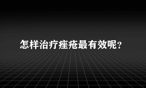 怎样治疗痤疮最有效呢？