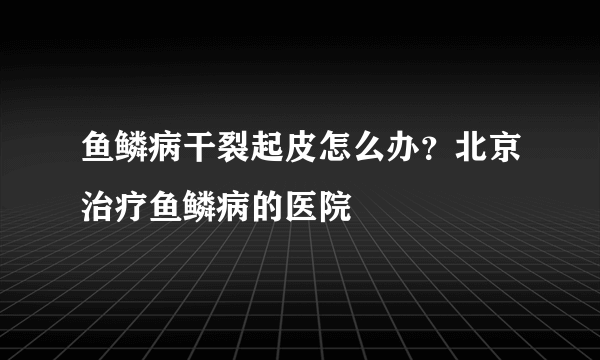 鱼鳞病干裂起皮怎么办？北京治疗鱼鳞病的医院