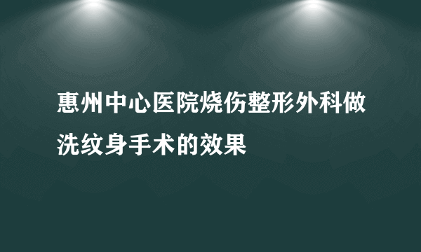 惠州中心医院烧伤整形外科做洗纹身手术的效果