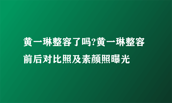 黄一琳整容了吗?黄一琳整容前后对比照及素颜照曝光