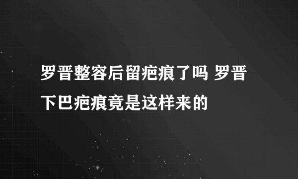 罗晋整容后留疤痕了吗 罗晋下巴疤痕竟是这样来的