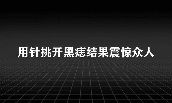 用针挑开黑痣结果震惊众人