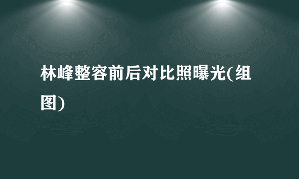 林峰整容前后对比照曝光(组图)