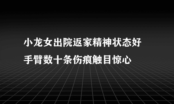 小龙女出院返家精神状态好 手臂数十条伤痕触目惊心