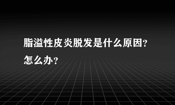 脂溢性皮炎脱发是什么原因？怎么办？