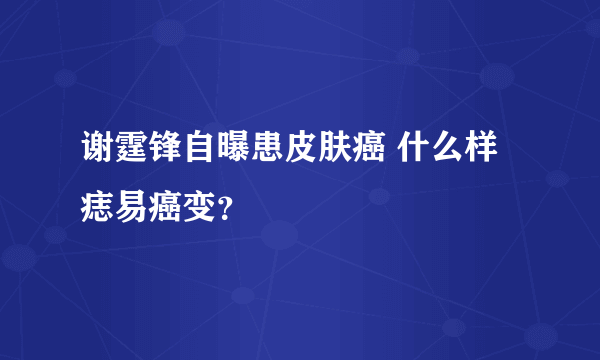 谢霆锋自曝患皮肤癌 什么样痣易癌变？