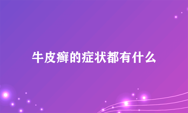 牛皮癣的症状都有什么