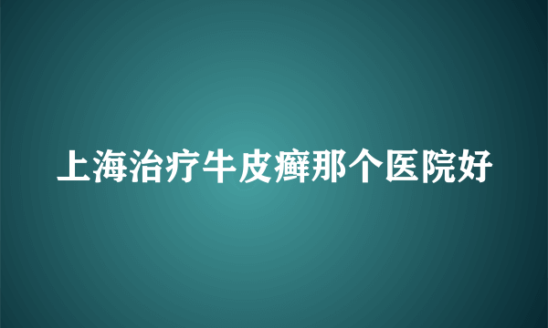 上海治疗牛皮癣那个医院好