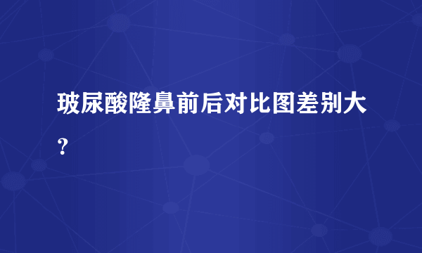 玻尿酸隆鼻前后对比图差别大？