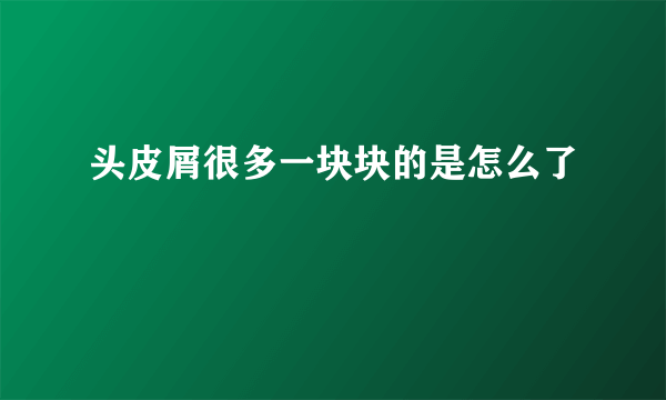 头皮屑很多一块块的是怎么了