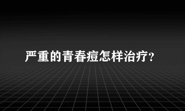 严重的青春痘怎样治疗？