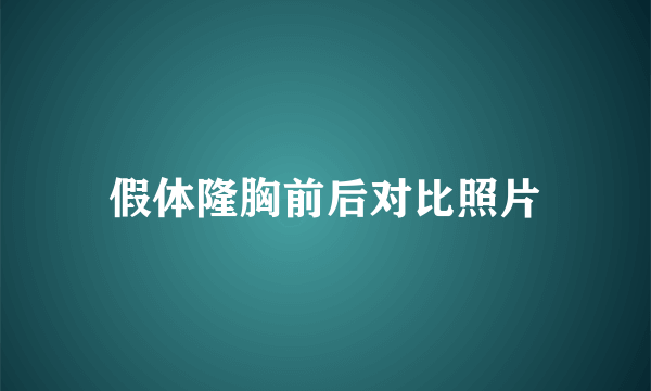 假体隆胸前后对比照片