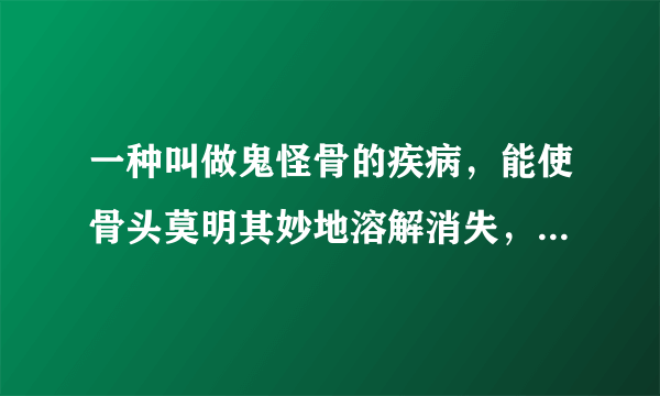 一种叫做鬼怪骨的疾病，能使骨头莫明其妙地溶解消失，是真的么？