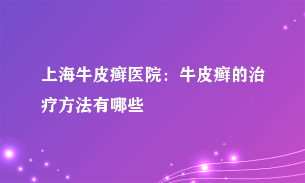 上海牛皮癣医院：牛皮癣的治疗方法有哪些