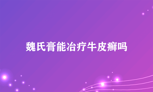 魏氏膏能冶疗牛皮癣吗