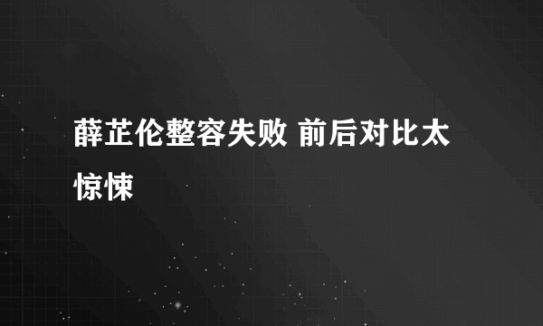 薛芷伦整容失败 前后对比太惊悚