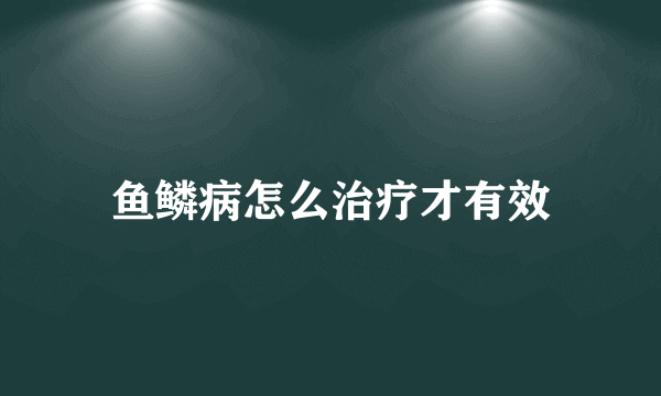 鱼鳞病怎么治疗才有效