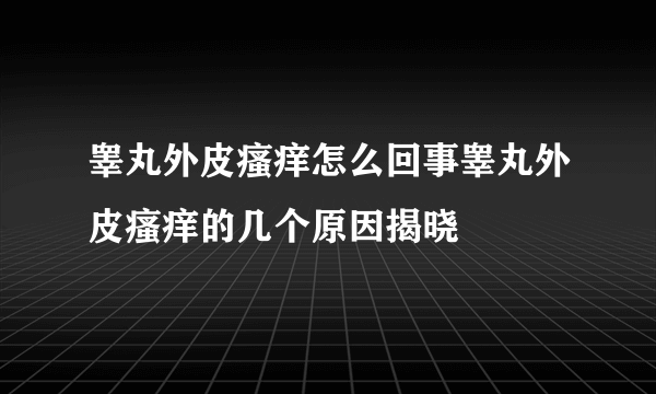 睾丸外皮瘙痒怎么回事睾丸外皮瘙痒的几个原因揭晓