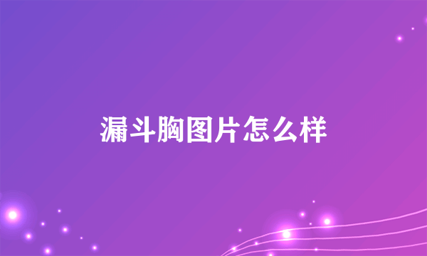 漏斗胸图片怎么样