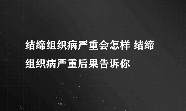 结缔组织病严重会怎样 结缔组织病严重后果告诉你