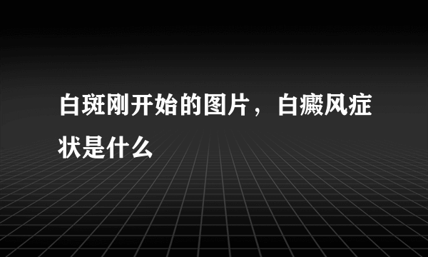 白斑刚开始的图片，白癜风症状是什么