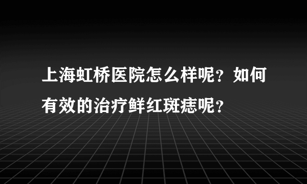 上海虹桥医院怎么样呢？如何有效的治疗鲜红斑痣呢？