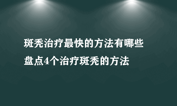 斑秃治疗最快的方法有哪些 盘点4个治疗斑秃的方法