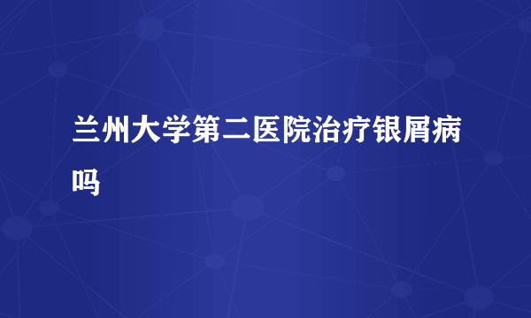 兰州大学第二医院治疗银屑病吗