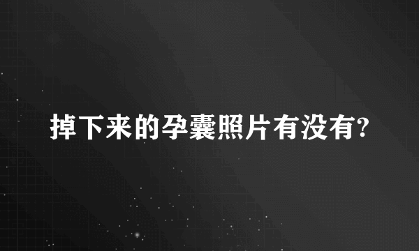 掉下来的孕囊照片有没有?